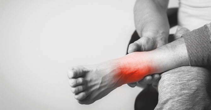 What is a high ankle sprain?